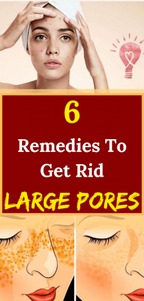 6 Remedies To Get Rid Large Pores 6 Remedies To Get Rid Large Pores