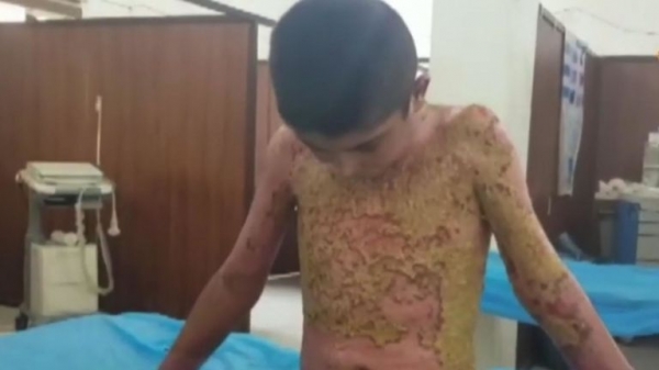 Turkish President Erdogan vows to 'crush the heads' of Kurds in Syria
Turkish President Erdogan vows to 'crush the heads' of Kurds in Syria