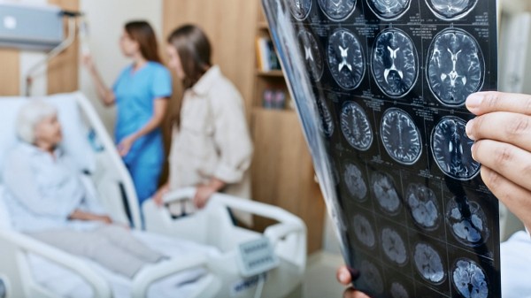 Higher stroke risk linked to consuming certain amount of alcohol, study finds