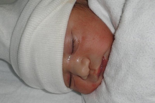 ByHeart recalls all infant formula amid botulism outbreak ByHeart recalls all infant formula amid botulism outbreak