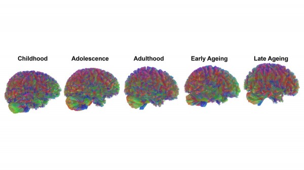 Your brain doesn’t age the way you think — new research upends old beliefs Your brain doesn’t age the way you think — new research upends old beliefs